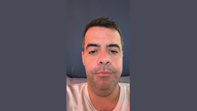 Entender a importância da compressão na mamografia ajuda a reduzir erros na análise, como destaca Vinicius Tadeu Sattin Rodrigues ao explicar sua necessidade