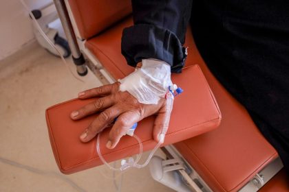 Close de uma mão recebendo quimioterapia por via intravenosa em uma unidade de saúde.